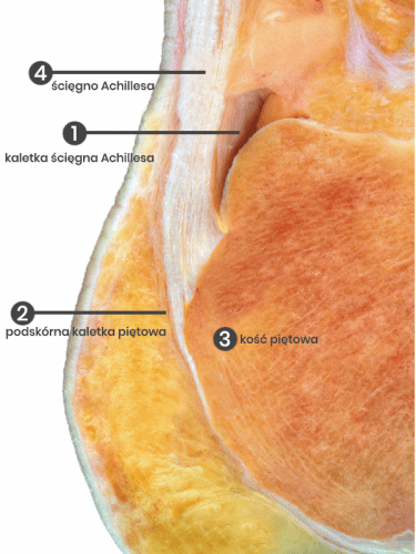 kaletki, kaletka piętowa, podskórna kaletka piętowa, kaletka ścięgna Achillesa, ścięgno Achillesa, pięta, kość piętowa, anatomia stopy
