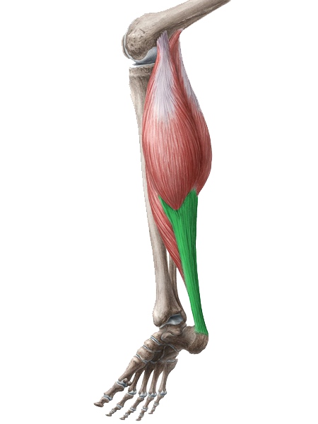 łydka, mięśnie łydki, zdrowa noga, noga z wadą, calf, calf muscles in clubfoot, calf muscles in normal foot, comparison, clubfoot, clubfeet, atrophy, gastrocnemius, mięsień brzuchaty łydki, triceps surae, mięsień płaszczkowaty, soleus muscle, męsień dwugłowy łydki, ścięgno Achillesa, Achilles tendon